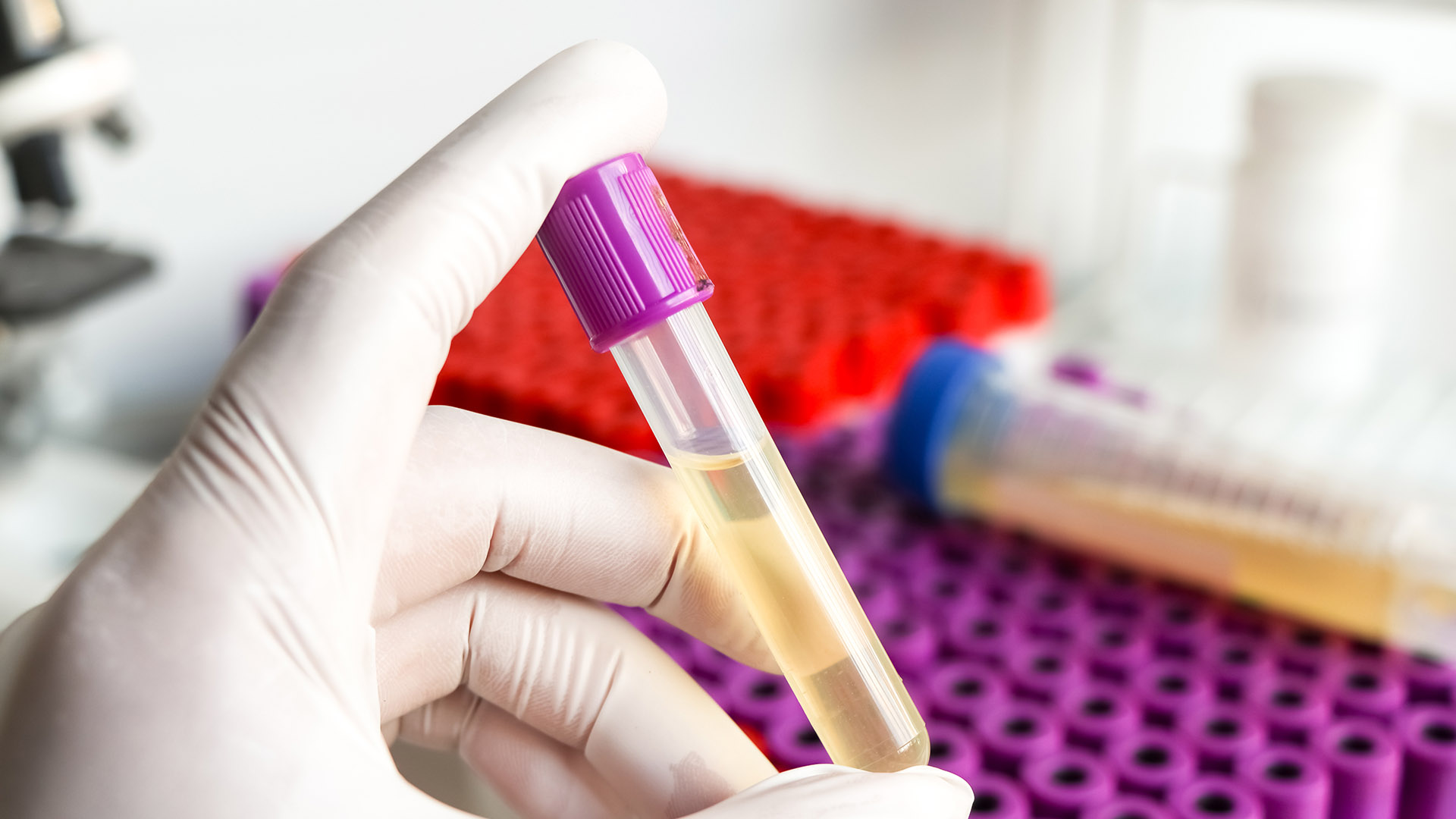 5 Signs of Bladder Cancer that Women Should Know 