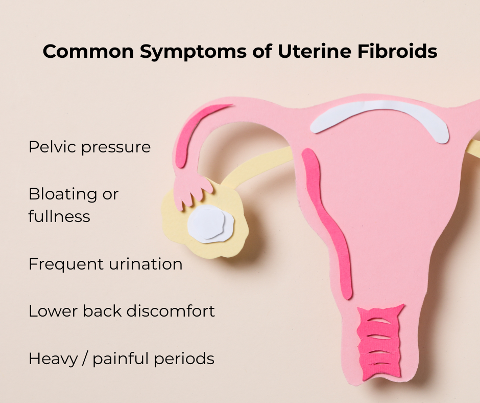 Fibroids