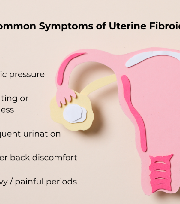 Fibroids