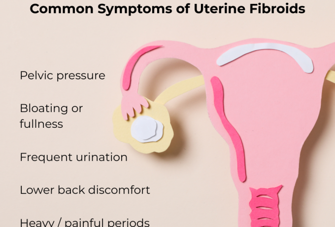 Fibroids
