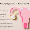 Fibroids